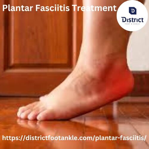 Plantar-Fasciitis-Treatmentfc76fde29f47cd1a.jpg