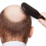Best-Hair-Loss-Treatment-In-Mumbai-India79839f85e5ba96b8