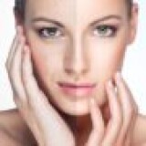 Chemical-Peel-Treatment-Before-And-After.9fce989180deac74