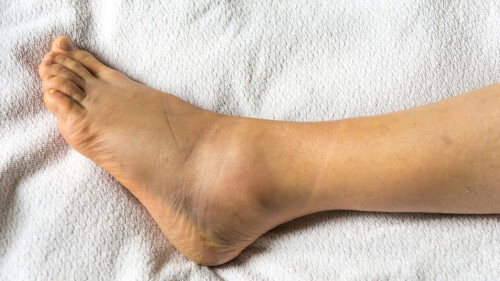 Apex Foot & Ankle Institute stands out as the Lower Extremities Specialist you can trust. Our professional team specializes in vast care for lower extremity issues, giving faithful diagnostics and advanced therapies. Trust on us for tailored solutions that prioritize your convenience and mobility, ensuring optimal results for your lower extremity health.
https://apexfootanklesurgery.com/