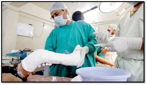 Trishla Ortho can assist you in understanding everything about foot surgery and its management. Dr. Jitendra Kumar Jain has expertise in foot deformities. Visit: https://www.trishlaortho.com/