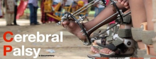 The Trishla Foundation is a non-profit organization,their goal is to assist all children and adults with cerebral palsy, provide them with better treatment and help them to become self-sufficient. For more details, visit their website.