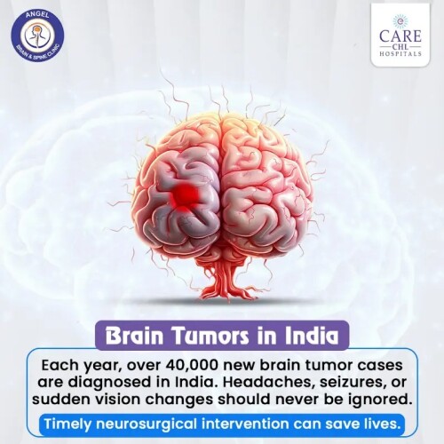 Brain-tumors-in-Indiad6a56d6c75db918b.jpg