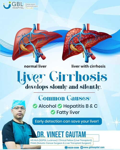 Liver-Cirrhosis-Treatment-Indorea92acfec84a0d7dc.jpg