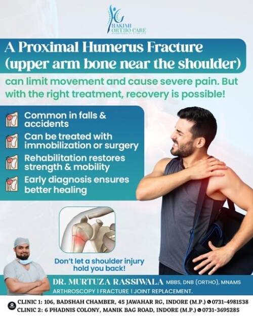 Proximal-Humerus-Treatment-in-indore-Dr-Murtuza-Rassiwala830f92b0d5944e5f.jpg
