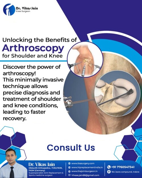 Arthroscopy-for-Quick-Recoveryedc29b00c5bbcd65.jpg