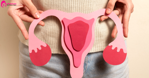 Adenomyosis-Treatment-in-Indore-Matricare-Clinic5aeb3581e571fbe6.png