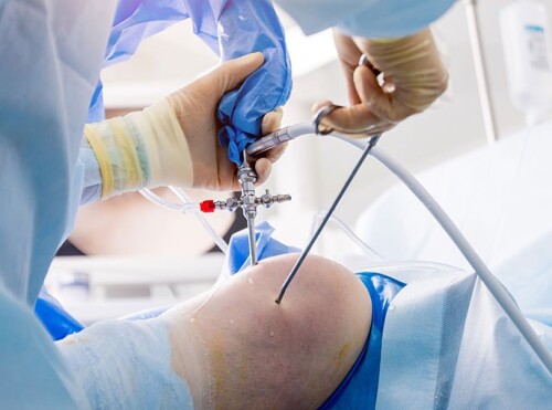 Knee-Arthroscopy-Surgery-in-Indorea303bcad22f7719c.jpg