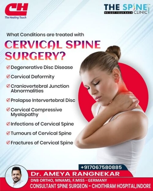 Cervical-Myelopathy-Surgery-in-Indore-Dr-Ameya-Rangnekar404f403881ac7dc1.jpg