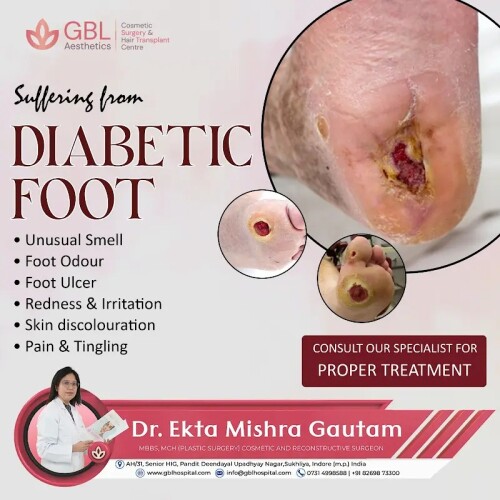 Dont-ignore-the-signs-of-diabetic-foot364ff9230d9040d0.jpg
