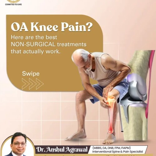Non-Surgical-OA-Knee-Treatment0ddf9c1a72674fa4.jpg