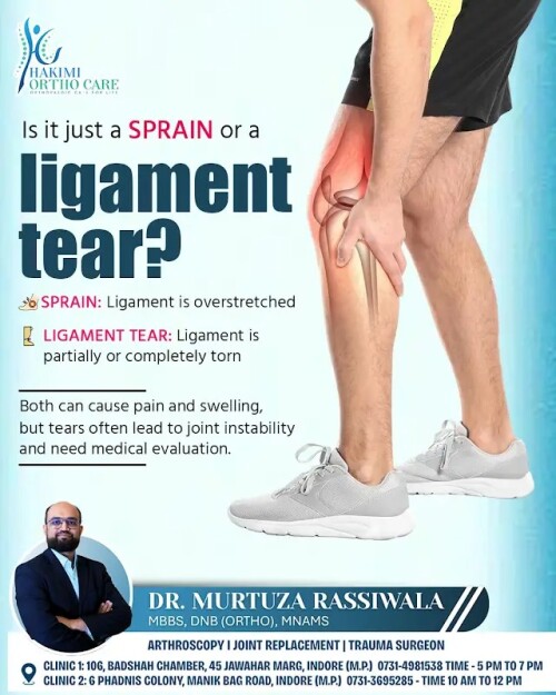 Understanding-the-Difference-Sprain-or-Ligament-Teare2a60c545007cf44.jpg