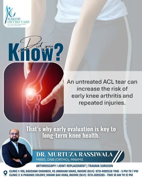 Why-You-Shouldnt-Ignore-an-Untreated-ACL-Tearb336fe2d1f5ea0b5.jpg