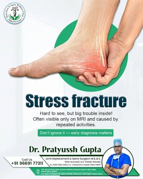 The-Hidden-Danger-Identifying-and-Treating-Stress-Fractures9380a07949771fb5.jpg